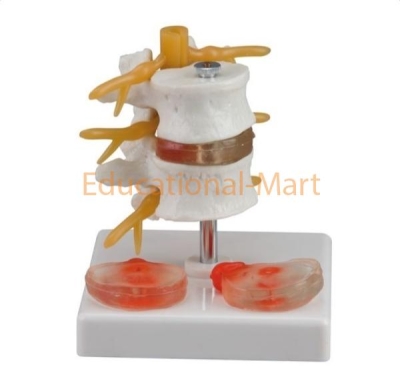 Educational Lumbar Anatomy Models