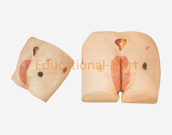 Advanced Adult Model for the Nursing of Incision of Trachea