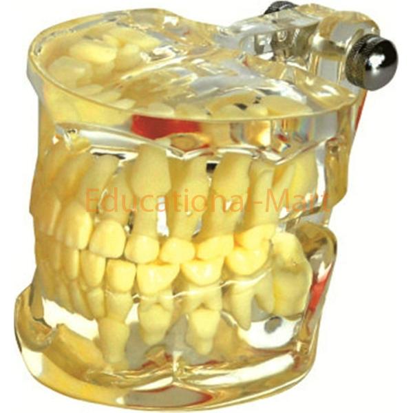 Clear Mixed Pentition