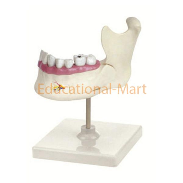 Half Lower Jaw Small