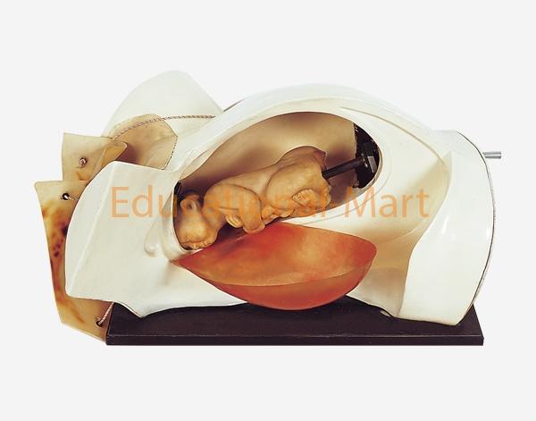 Human Parturition