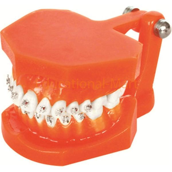 Metal Bracket Orthodonics Model
