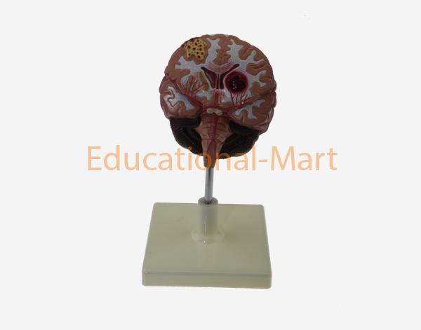 Model of Brain Pathologies