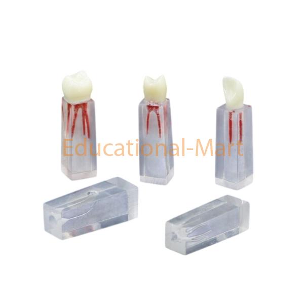 Model of Dental Pulp