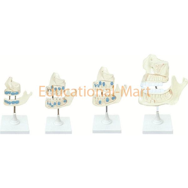 Model of Dentition