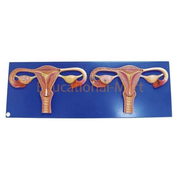 Natural Uterus