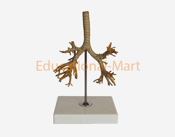 The Trachea,Bronchi and Broncho-Pulmonary Segments