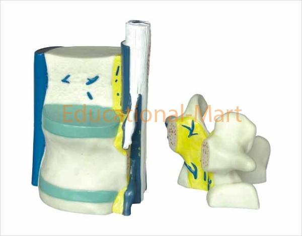 Vertebral and Parti